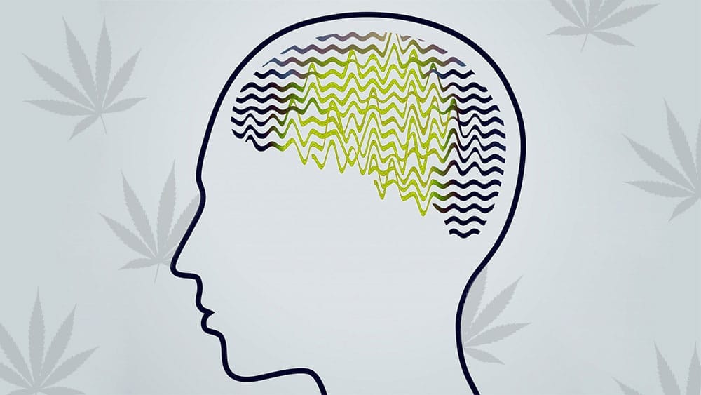 Epilessia-e-cbd