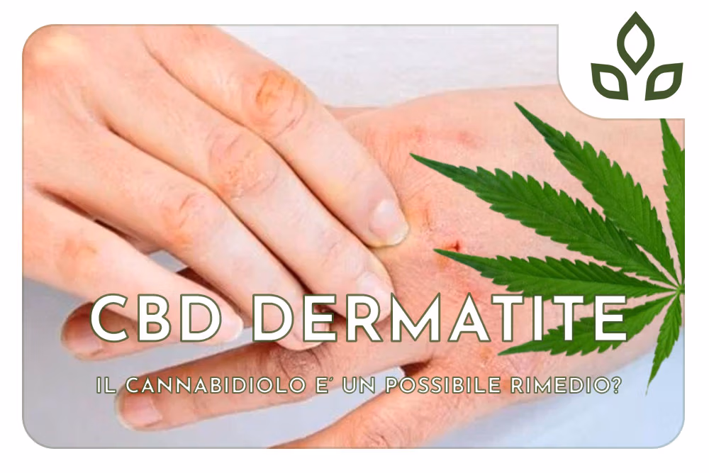 cbd dermatite